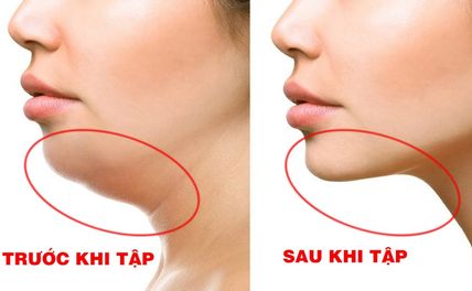 10 Bài Tập Giúp Giảm Mỡ Nọng Cằm Thành Vline Thon Gọn