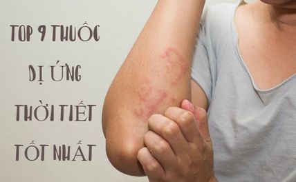 Top 9 thuốc dị ứng thời tiết tốt nhất an toàn, hiệu quả
