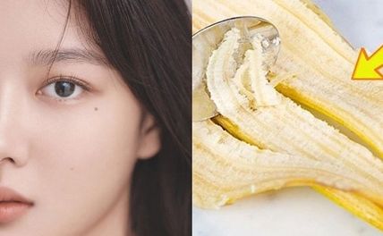 15 cách tẩy nốt ruồi trong 1 ngày hiệu quả tại nhà không phải ai cũng biết 