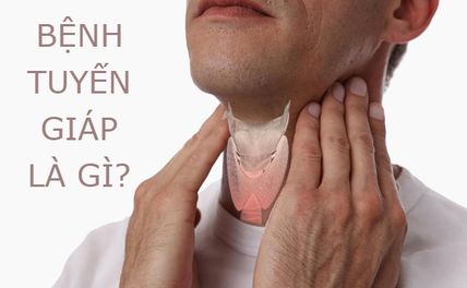 Bệnh tuyến giáp là gì? Triệu chứng và cách điều trị?