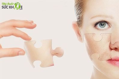 Những bệnh không nên uống Collagen bạn nên biết và lưu ý
