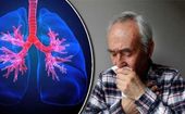 Top 12 thuốc bổ phổi, thải độc phổi được tin dùng nhất hiện nay