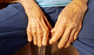 Phong: Nguyên nhân, biểu hiện, phương pháp điều trị hiệu quả