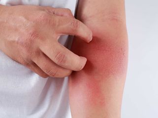 Viêm bao hoạt dịch: Nguyên nhân, biểu hiện, phương pháp điều trị hiệu quả