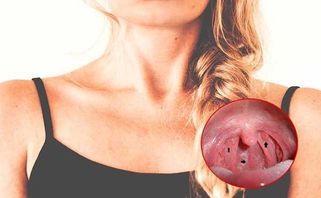 Dấu hiệu ung thư vòm họng và cách phòng bệnh từ sớm
