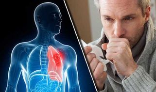 8 dấu hiệu ung thư phổi giúp phát hiện bệnh sớm