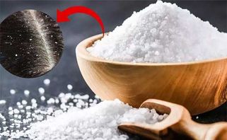 4 cách trị nấm da đầu hiệu quả, ngăn ngừa tái phát