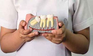 Hiểu rõ hơn về răng khôn? Nên để hay nhổ răng khôn?