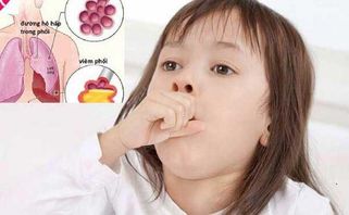 Viêm phổi ở trẻ em: cách nhận biết sớm và phòng ngừa