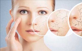 Da mặt khô: nguyên nhân, biểu hiện và biện pháp giúp da ẩm mịn