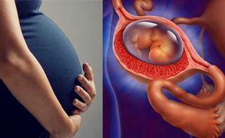 Dấu hiệu mang thai ngoài tử cung chị em cần nhận biết sớm