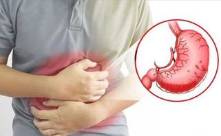 Triệu chứng đau dạ dày và nguyên nhân khởi phát 