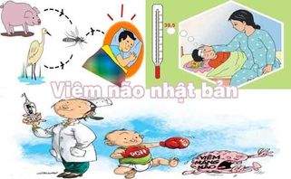 Viêm não Nhật Bản là gì? Triệu chứng và cách phòng ngừa?
