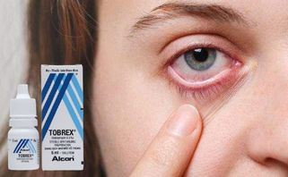 Dung dịch nhỏ mắt Tobrex có tác dụng gì? Cách sử dụng và giá bán? 