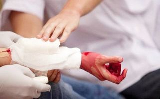 TOP 12 thuốc cầm máu vết thương nhanh trong trường hợp nguy cấp
