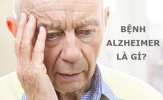 Bệnh Alzheimer là gì? Bệnh Alzheimer ở người trẻ tuổi