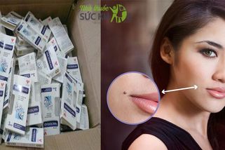Tẩy Nốt Ruồi Bằng Thuốc Chấm Và Những Điều Cần Biết 