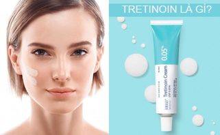Tre là gì? Tre loại nào tốt nhất và cách sử dụng đúng chuẩn an toàn