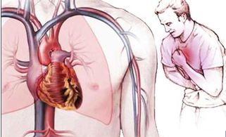 Bệnh mạch vành có nguy hiểm không? Những ai có nguy cơ mắc phải