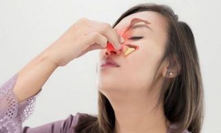 Chữa viêm xoang dứt điểm tại nhà bằng cách nào? Bài thuốc chữa viêm xoang tốt nhất