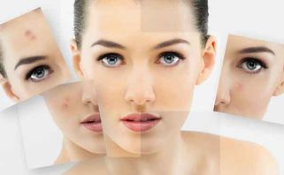 Top 12 sữa rửa mặt trị mụn tốt nhất có thể sử dụng cho cả 4 mùa