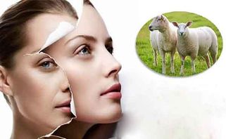 Review Top 7 Viên Uống Nhau Thai Cừu Tốt Nhất Hiện Nay