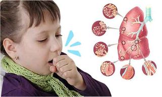 Bệnh ho gà là gì? Dầu hiệu nhận biết và cách điều trị ho gà hiệu quả