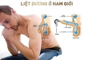 Liệt dương là gì? Nguyên nhân, dấu hiệu và cách phòng ngừa?