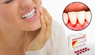 Rutin C là thuốc gì? Giá bao nhiêu? Cách sử dụng như thế nào?