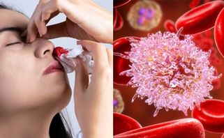 Bệnh máu trắng là gì? Bệnh máu trắng sống được bao lâu?