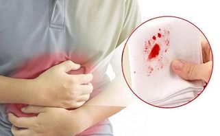 Ói ra máu là bệnh gì? Biến chứng nguy hiểm và cách điều trị