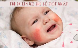 Top 15 Kem nẻ cho bé tốt nhất 2025 được nhiều mẹ tin dùng