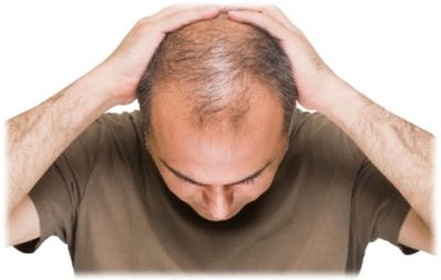 Mọc tóc, trị hói